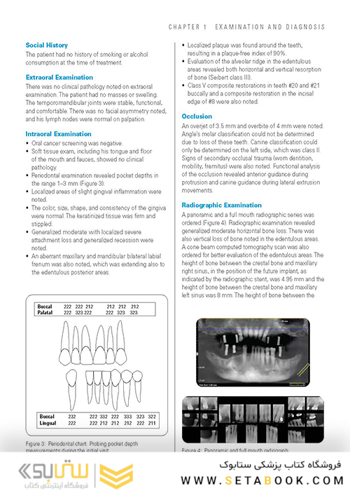 Clinical Cases in Implant Dentistry