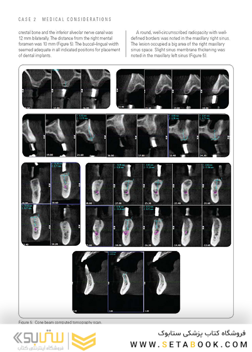 Clinical Cases in Implant Dentistry
