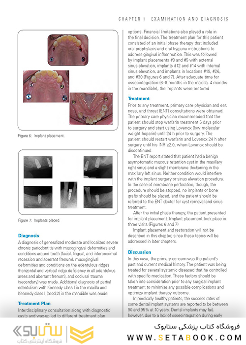 Clinical Cases in Implant Dentistry