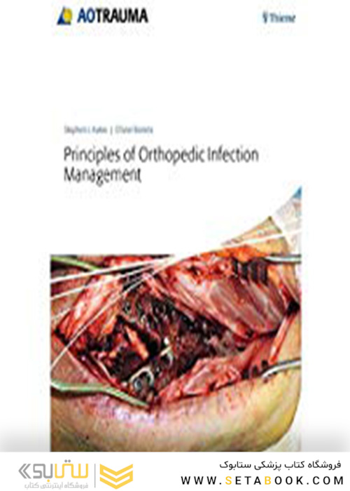 Principles of Orthopedic Infection Management