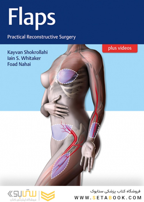 Flaps : Practical Reconstructive Surgery