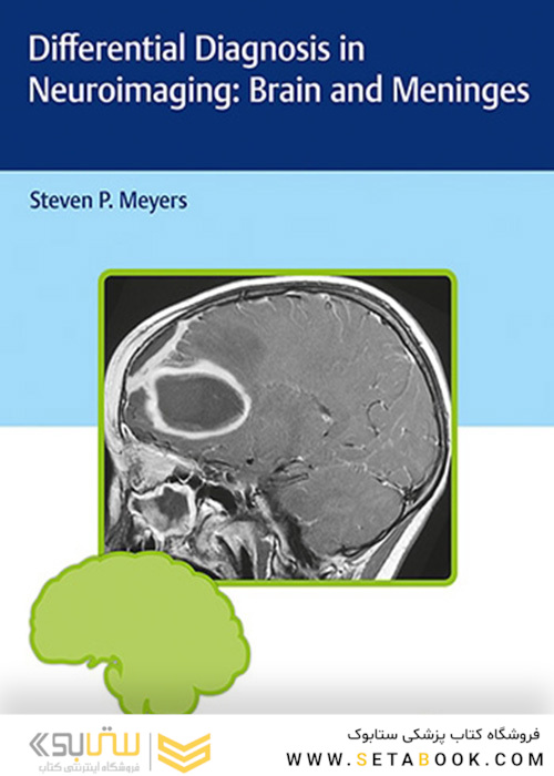 Differential Diagnosis in Neuroimaging: Brain and Meninges