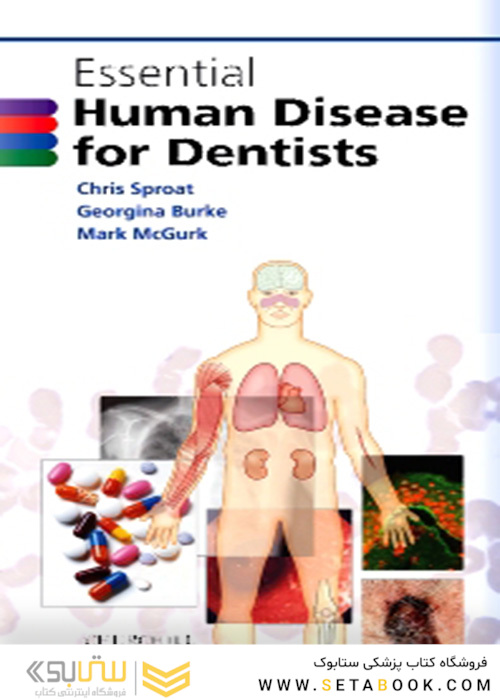 Essential Human Disease for Dentists 