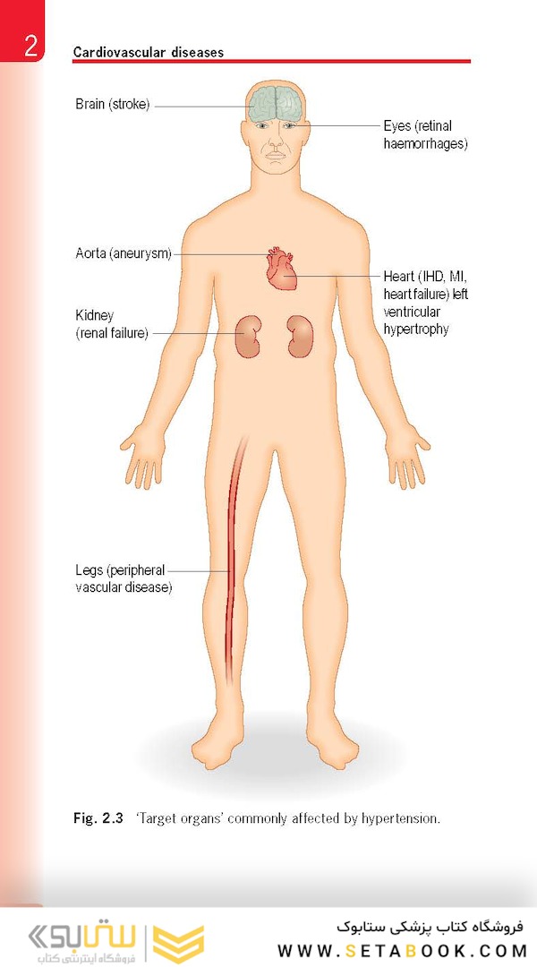 Essential Human Disease for Dentists 