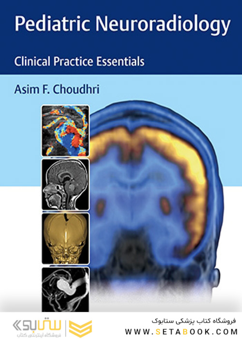 Pediatric Neuroradiology : Clinical Practice Essentials