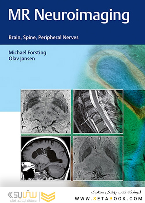 MR Neuroimaging : Brain, Spine, and Peripheral Nerves