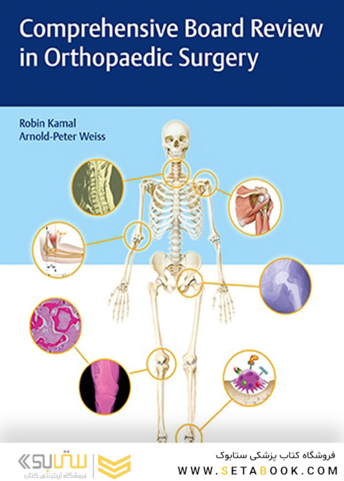Comprehensive Board Review in Orthopaedic Surgery