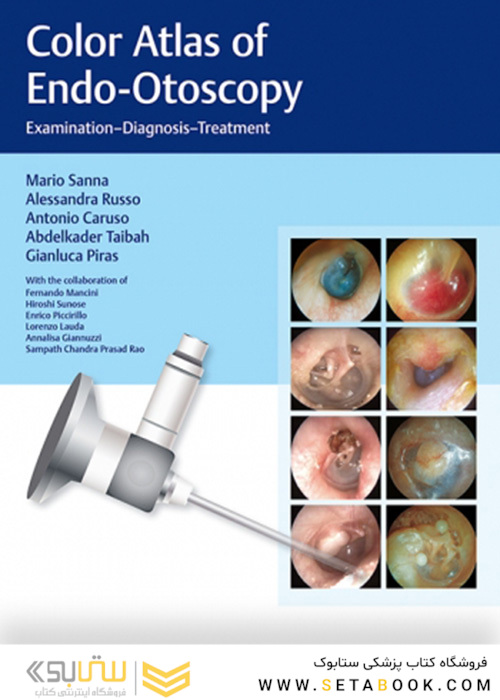 Color Atlas of Endo-Otoscopy : Examination-Diagnosis-Treatment