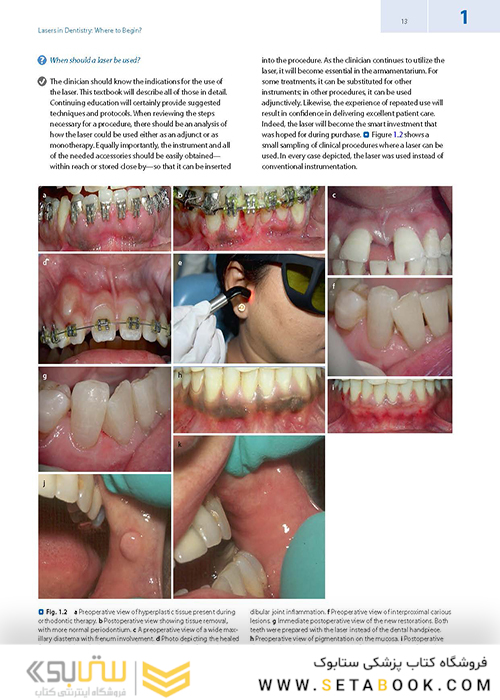 Lasers in Dentistry-Current Concepts