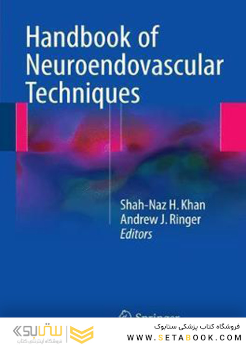 Handbook of Neuroendovascular Techniques
