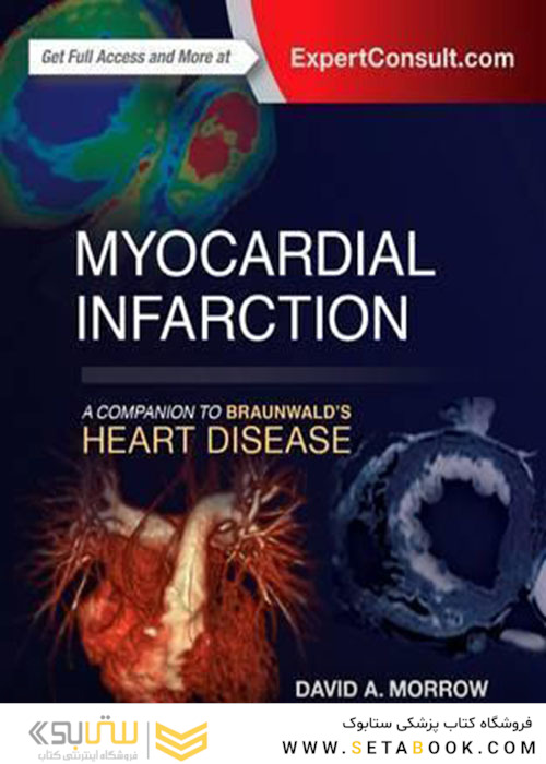 Myocardial Infarction: A Companion to Braunwald