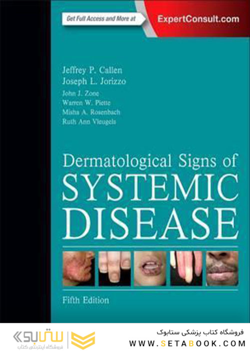 Dermatological Signs of Systemic Disease