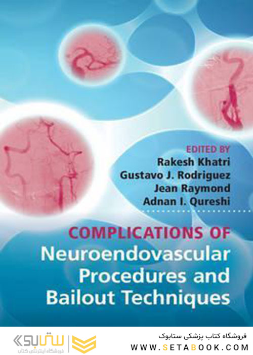 Complications of Neuroendovascular Procedures and Bailout Techniques