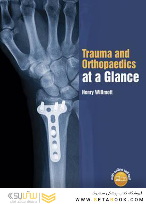 Trauma and Orthopaedics at a Glance