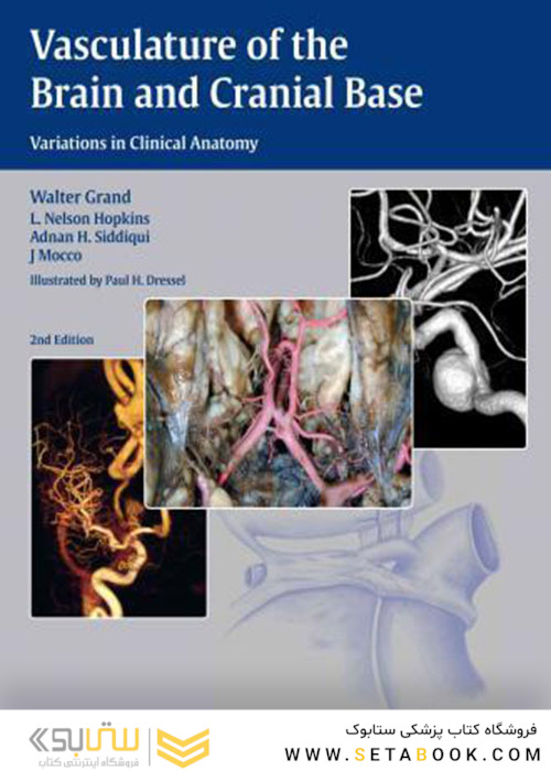 Vasculature of the Brain and Cranial Base