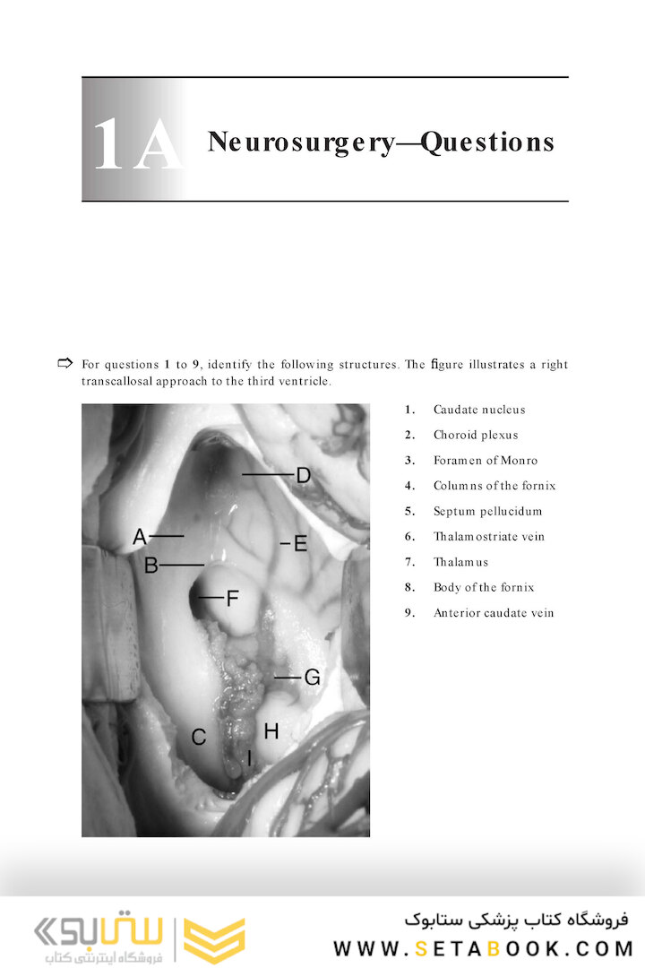 Neurosurgery Board Review : Questions and Answers for Self-Assessment