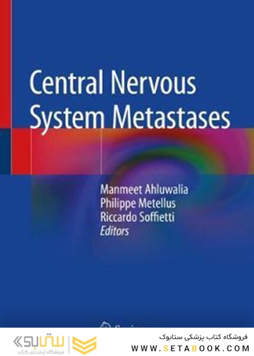 Central Nervous System Metastases متاستازهای سیستم عصبی مرکزی