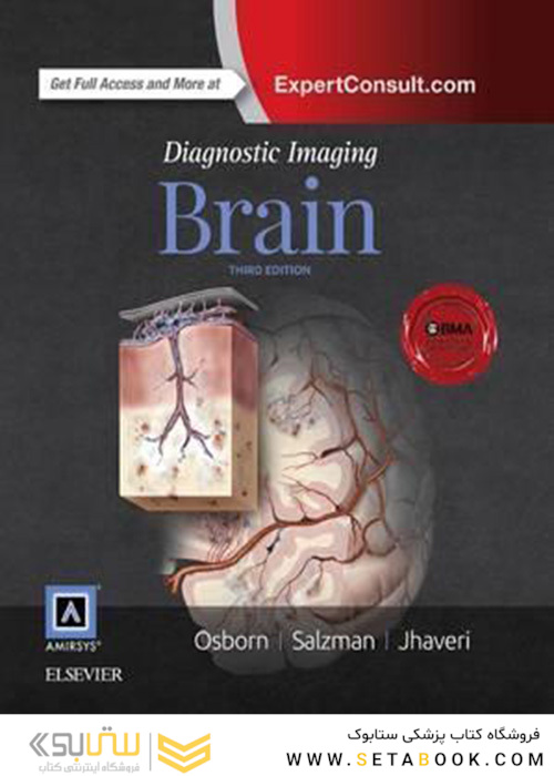 Diagnostic Imaging: Brain