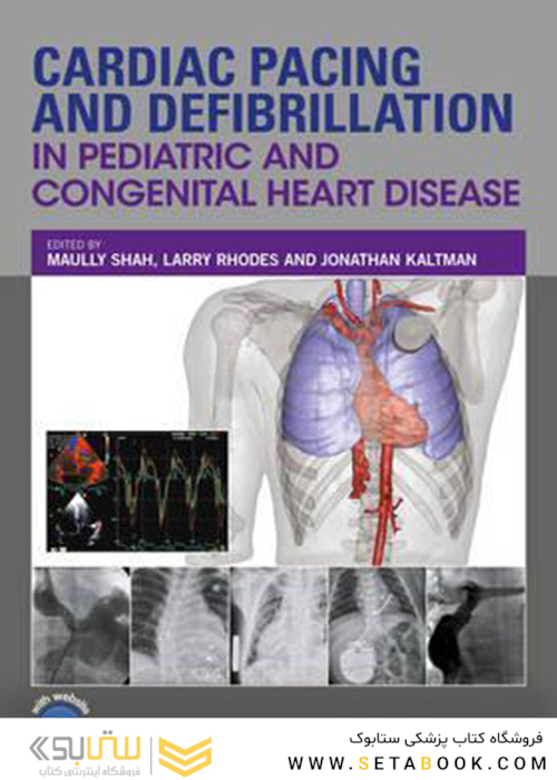 Cardiac Pacing and Defibrillation in Pediatric and Congenital Heart Disease