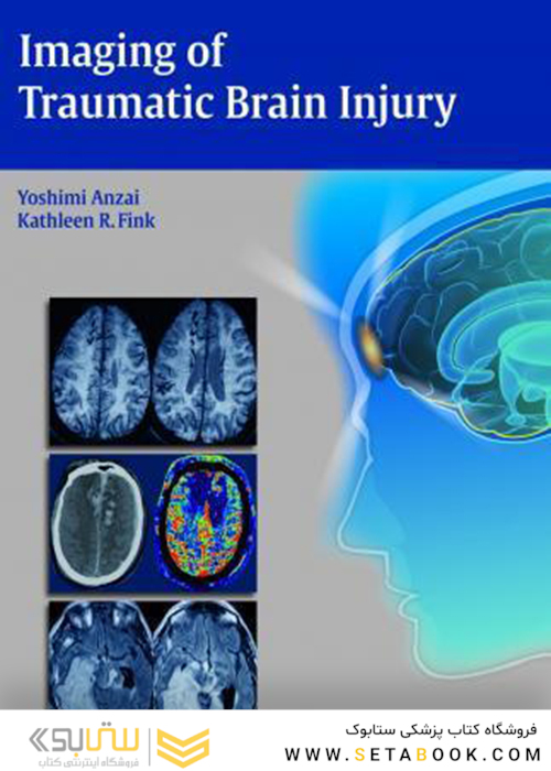 Imaging of Traumatic Brain Injury