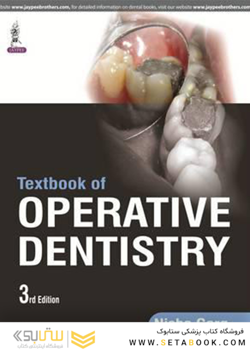 Textbook of Operative Dentistry