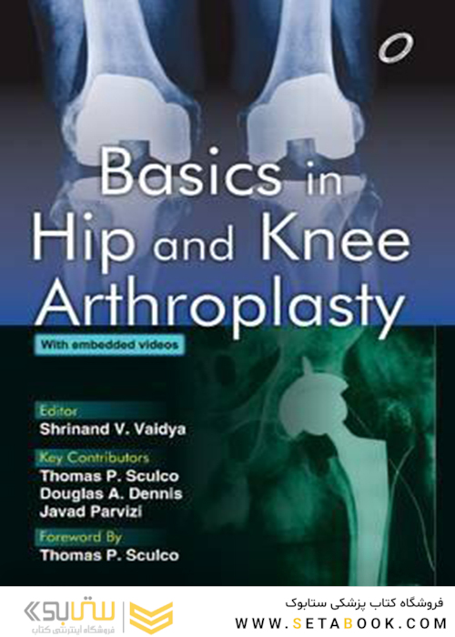 Basics in Hip and Knee Arthroplasty