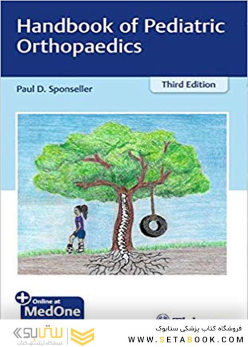 Handbook of Pediatric Orthopaedics