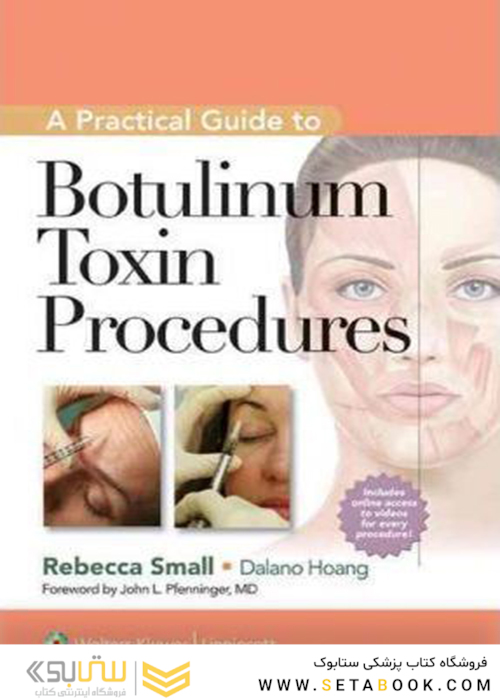 A Practical Guide to Botulinum Toxin Procedures