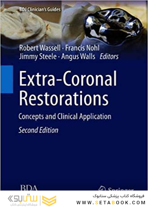 Extra-Coronal Restorations : Concepts and Clinical Application