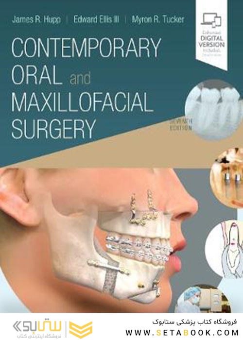 Contemporary Oral and Maxillofacial Surgery