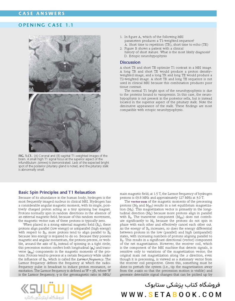 Duke Review of MRI Physics: Case Review Series