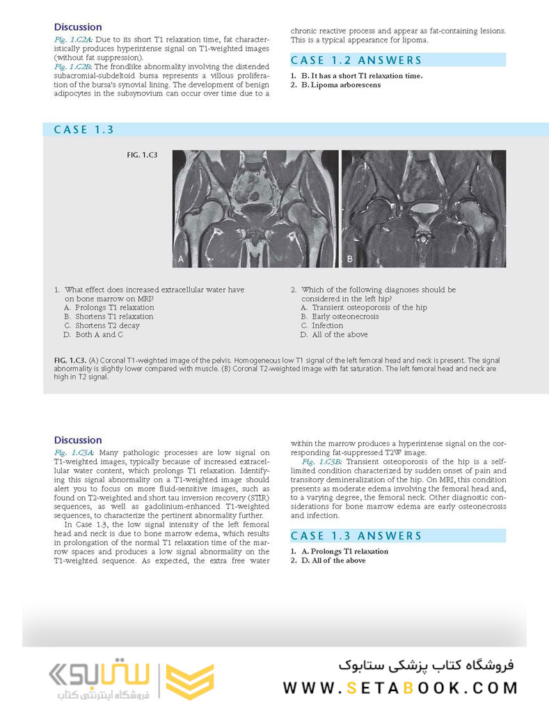 Duke Review of MRI Physics: Case Review Series