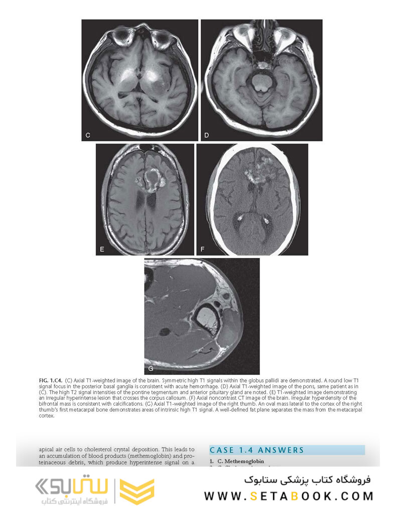 Duke Review of MRI Physics: Case Review Series