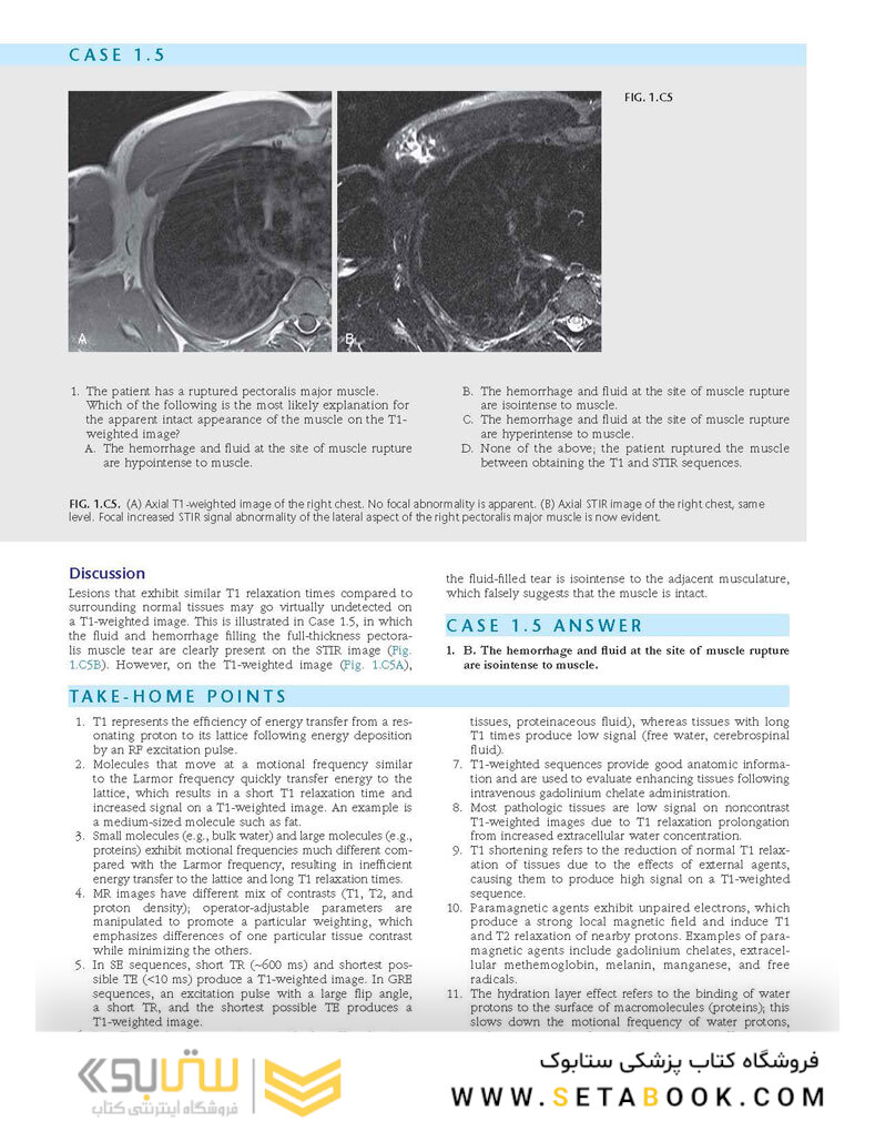 Duke Review of MRI Physics: Case Review Series
