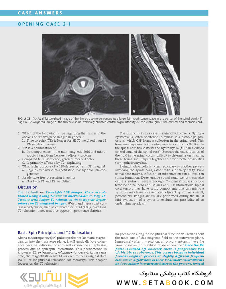 Duke Review of MRI Physics: Case Review Series