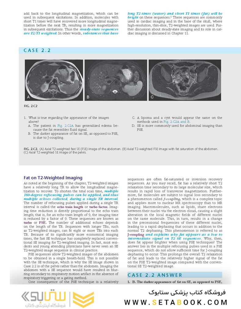 Duke Review of MRI Physics: Case Review Series