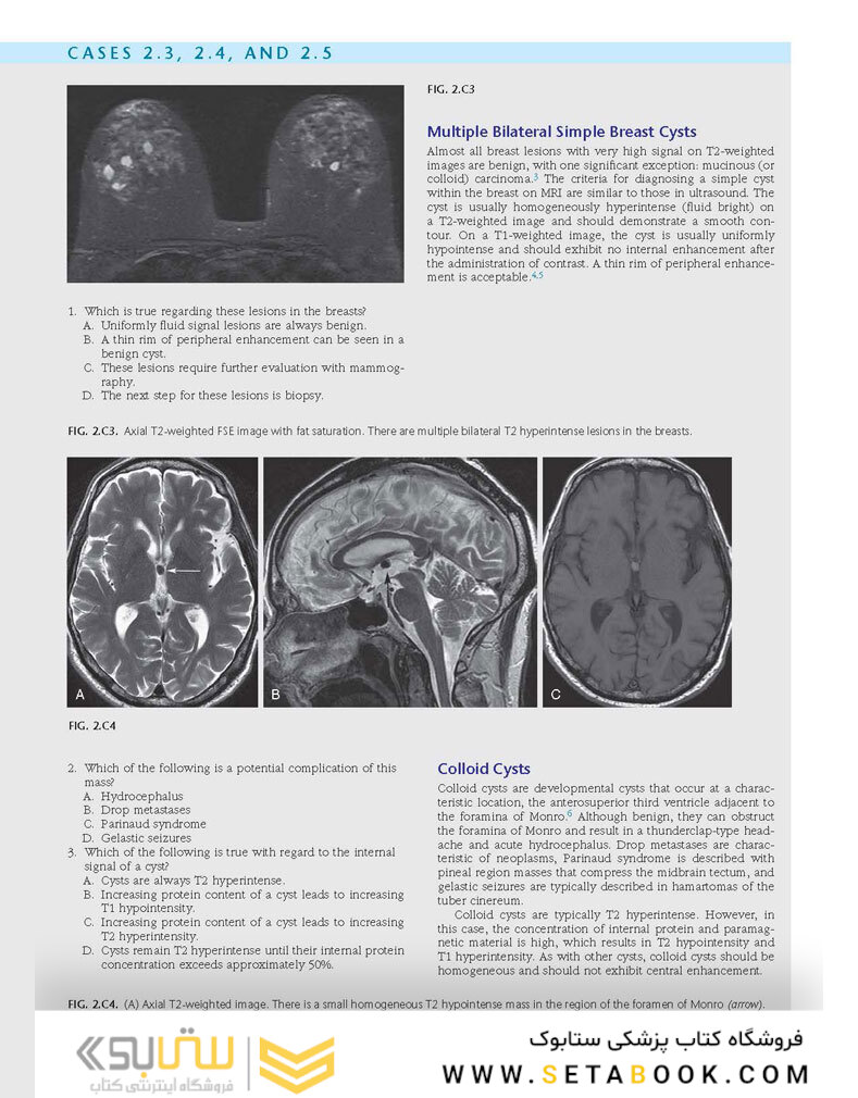 Duke Review of MRI Physics: Case Review Series