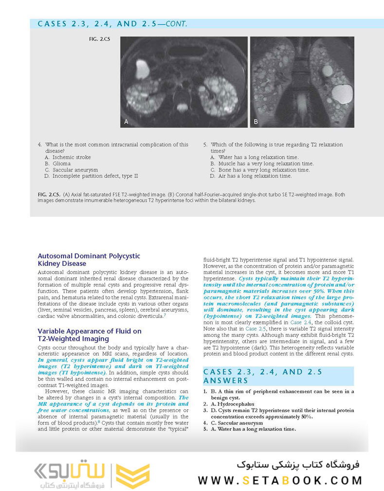 Duke Review of MRI Physics: Case Review Series
