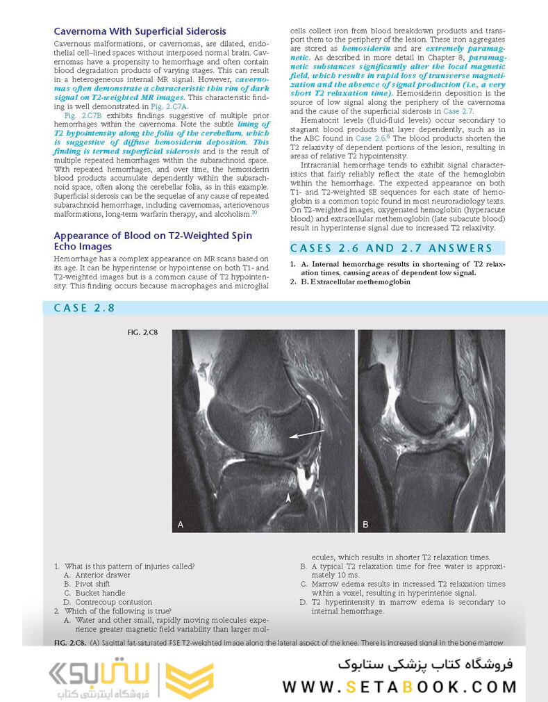 Duke Review of MRI Physics: Case Review Series