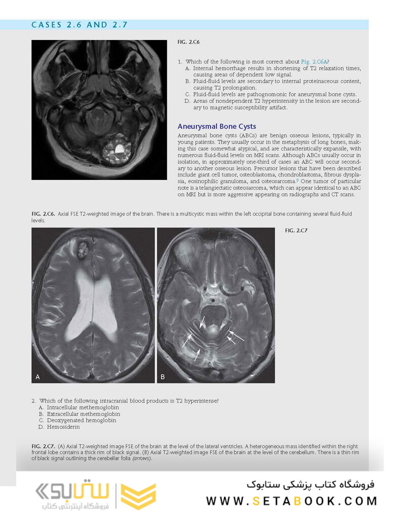 Duke Review of MRI Physics: Case Review Series