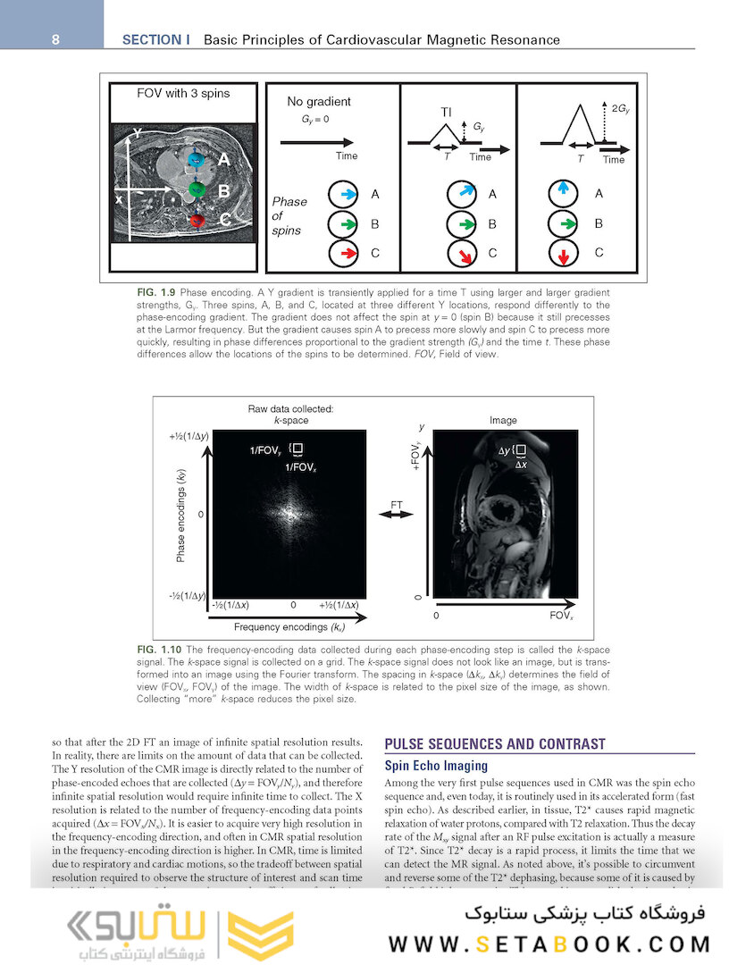 Cardiovascular Magnetic Resonance : A Companion to Braunwald