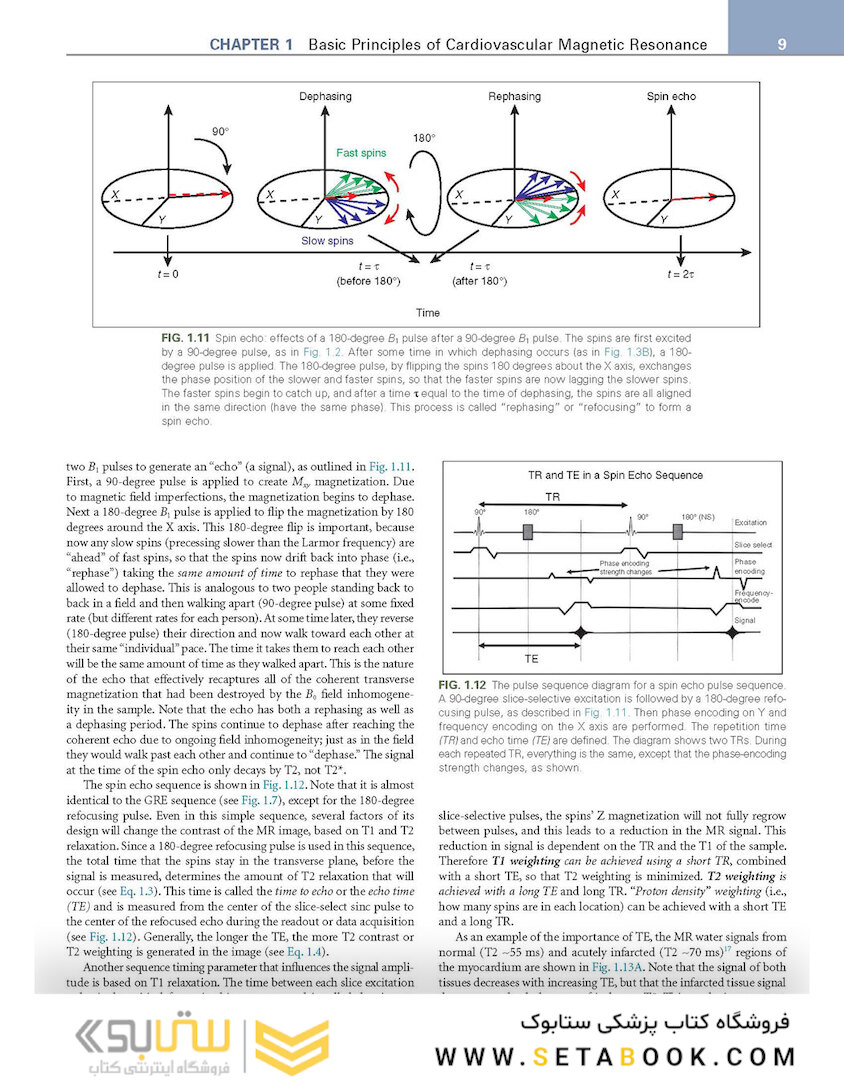 Cardiovascular Magnetic Resonance : A Companion to Braunwald