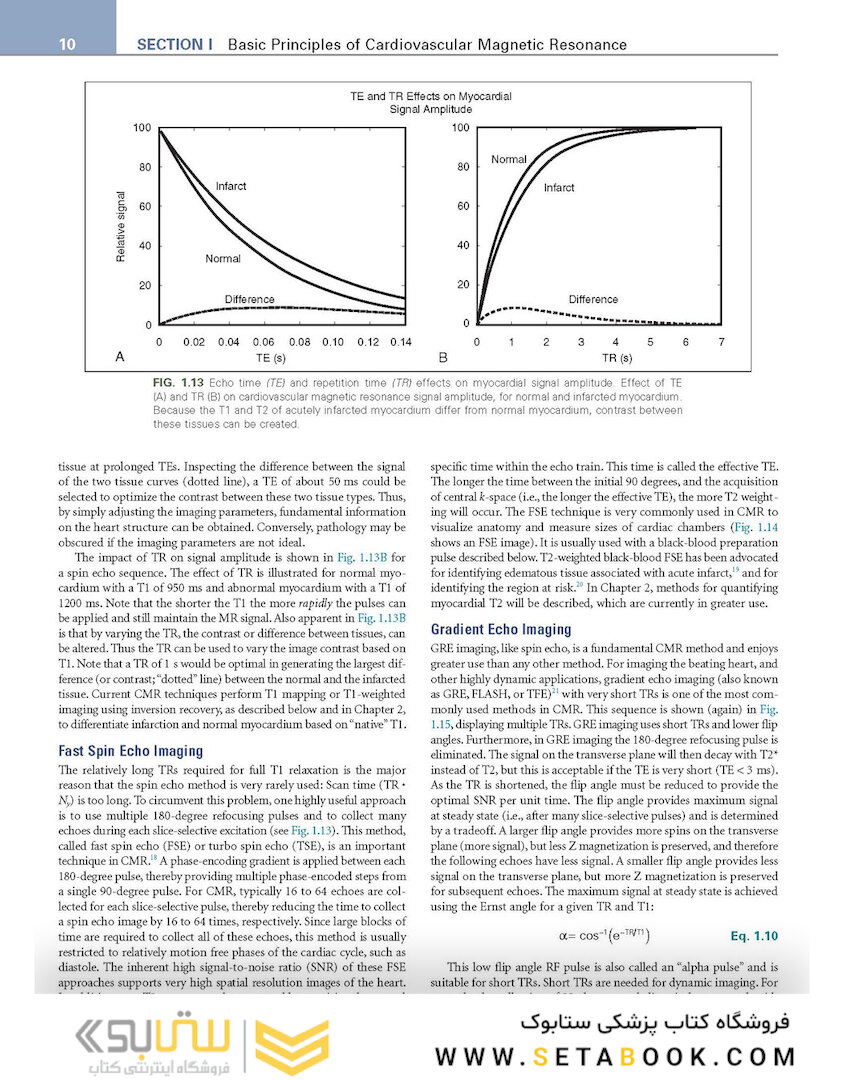 Cardiovascular Magnetic Resonance : A Companion to Braunwald