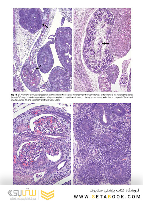  آسیب شناسی جراحی ارولوژیک نسخه 4 Urologic Surgical Pathology 2020