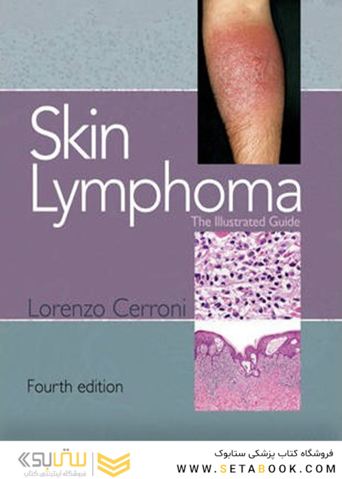 Skin Lymphoma : The Illustrated Guide