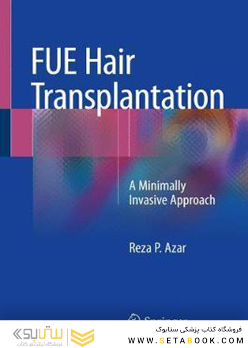 Fue Hair Transplantation : A Minimally Invasive Approach