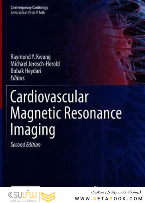 Cardiovascular Magnetic Resonance Imaging