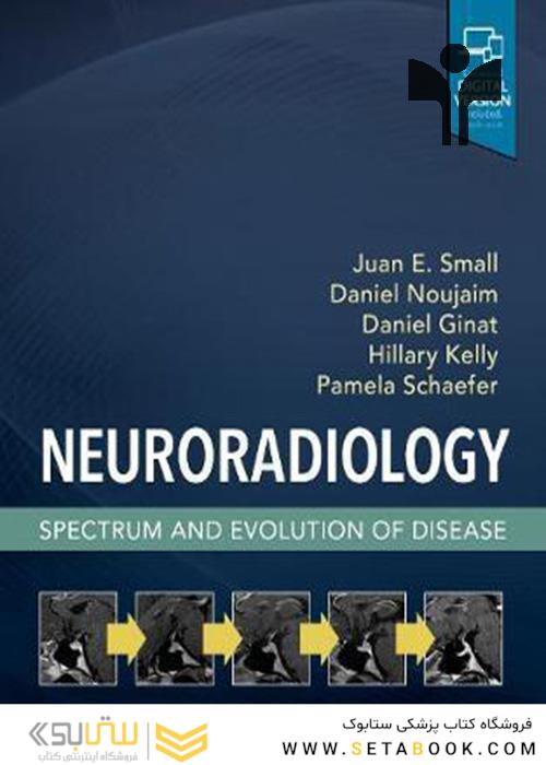 Neuroradiology: Spectrum and Evolution of Disease