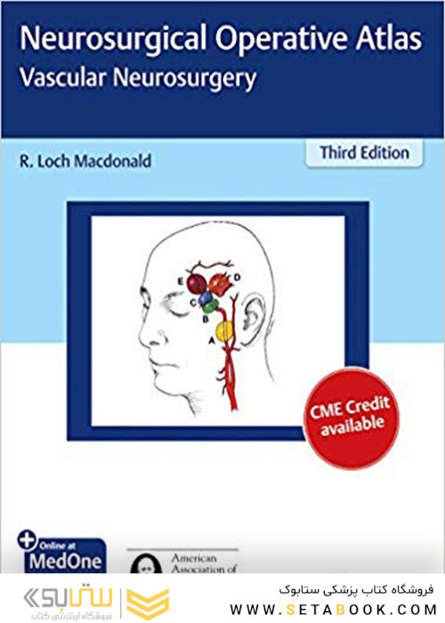 Neurosurgical Operative Atlas: Vascular Neurosurgery