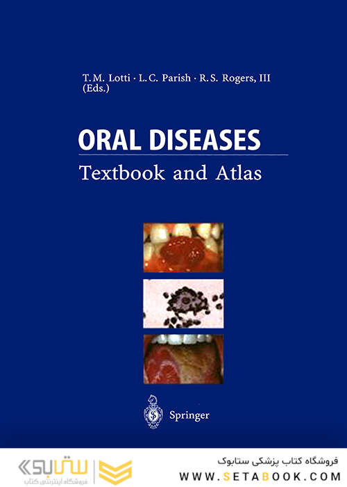 Oral Diseases : Textbook and Atlas